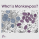 Viruela del Mono (Mpox) en el Condado de Tulare